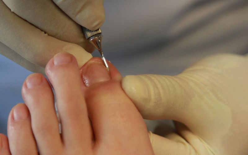 Lee más sobre el artículo ¿Qué hubiera pasado si no se hubiera desarrollado la podología?